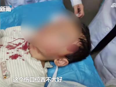 寻找肇事者！郑州4岁男孩公园玩耍被撞倒 头上摔出两个血洞