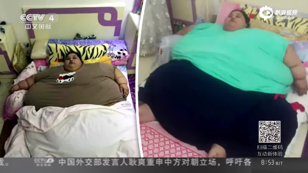 “世界最重”女性成功减重242公斤 终于可以坐起